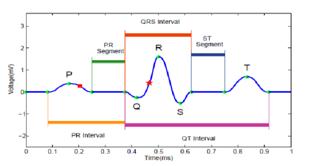 Baseline Wander Noise