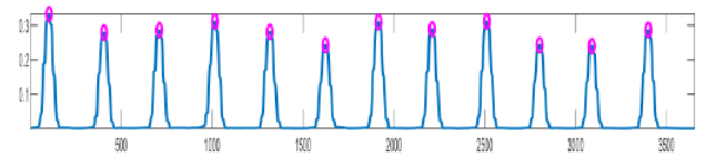 Baseline Wander Noise