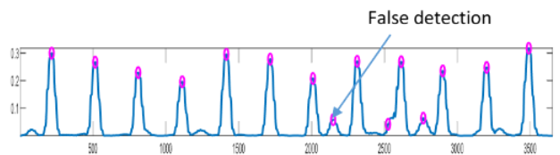 Baseline Wander Noise