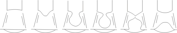 Metal transfer in the form drops